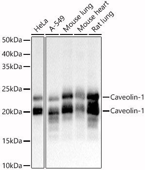 Western blot analysis of various lysates, using Caveolin-1 antibody (STJ28041) at 1:900 dilution. Secondary antibody: HRP Goat Anti-rabbit IgG (H+L) (STJS000856) at 1:10000 dilution. Lysates/proteins: 25 Mu g per lane. Blocking buffer: 3% non-fat dry milk in TBST. Detection: ECL Basic Kit. Exposure time: 1s.